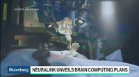 relates to Elon Musk's Startup Neuralink Plans to Merge Brain & AI