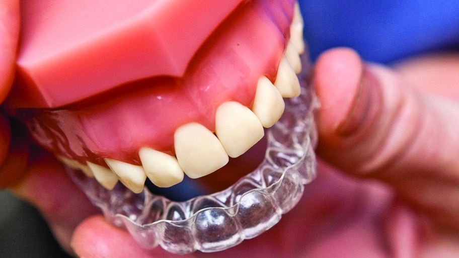 Dentist shows off Invisalign teeth aligners