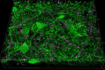 This shows amygdala neurons