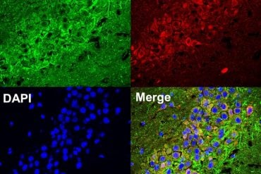 This shows hippocampal brain slices