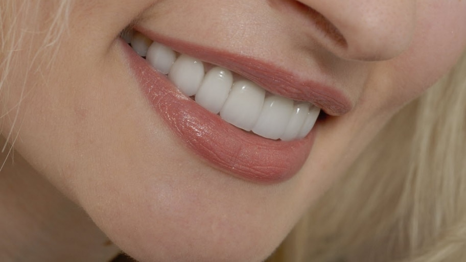 a woman&#039;s teeth are revealed when she smiles.