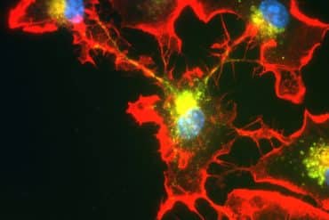 This shows microglia cells