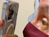 EyePhone: How one doctor is using the iPhone 13 Pro's macro capabilities to remotely assess patients