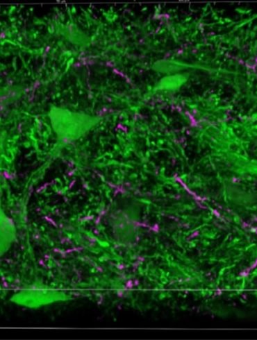 This shows amygdala neurons