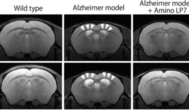 This shows brain scans from the study