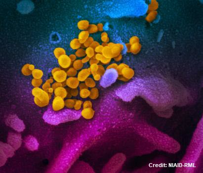 Novel Coronavirus, Image credit NIAID-RML