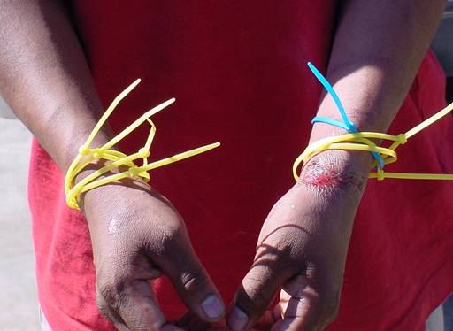 A noncitizen who was restrained with plastic ties and injured by smugglers after entering the U.S.