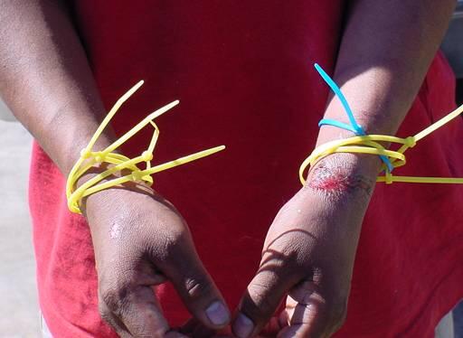 An noncitizens who was restrained with plastic ties and injured by smugglers after entering the U.S.