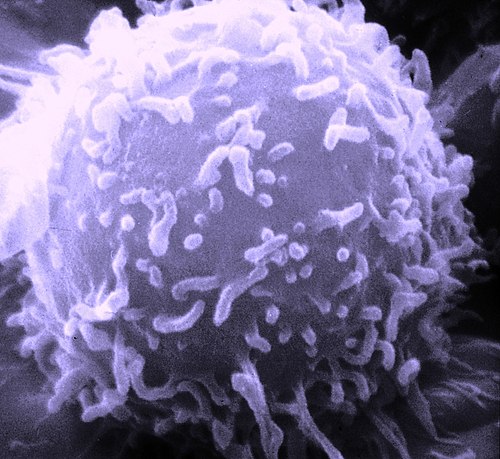 SEM Lymphocyte.jpg