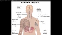 File:En.Wikipedia-VideoWiki-HIV-AIDS.webm