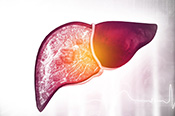 Shifting risk factors for cirrhosis - Photo: iStock/Rasi Bhadramani