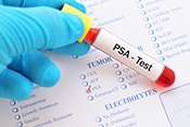 Low-value prostate cancer screening prevalent in VA - Photo: ©iStock/jarun011