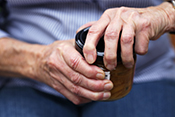 Multiple medical conditions linked to arthritis-causing disease - Photo: ?iStock/bloodstone