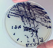 C. difficile treatment with vancomycin results in fewer deaths than treatment with metronidazole - ?iStock/Scharvik