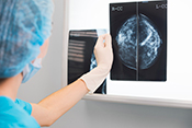 Electronic trigger detects mammogram follow-up delays - Photo: ?iStock/thomasandreas