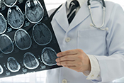 MRI could help detect early Alzheimer?s - Photo: ?iStock/utah778