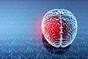 More study needed on TBI?s effect of psychiatric treatment - Illustration ?iStock/laramenko