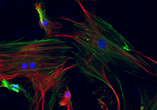 Rebuilding cartilage using collagen scaffolding - Photo: Ames Laboratory, U.S. Dept. of Energy