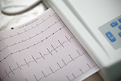 Testosterone replacement therapy could lower risk of atrial fibrillation - Photo: ©iStock/sudok1