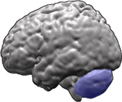 Study yields insight on TBI damage