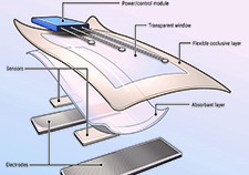 VA researcher develops 'smart bandage' technology for chronic wounds