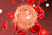 Blood cancer patients with cognitive impairment may have worse survival - Photo: ?iStock/Dr._Microbe