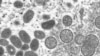 FILE - This 2003 electron microscope image made available by the Centers for Disease Control and Prevention shows mature, oval-shaped monkeypox virions, left, and spherical immature virions, right, obtained from a sample of human skin associated with the 