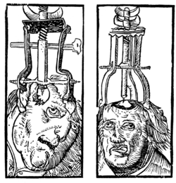 Trepanation