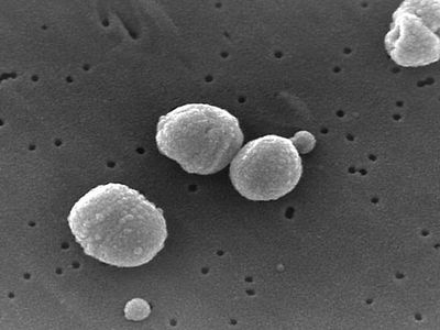 Streptococcus pneumoniae