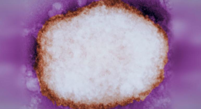 A highly-magnified image shows a mulberry-type Monkeypox virus particle, which was found in the fluid of a human blister.