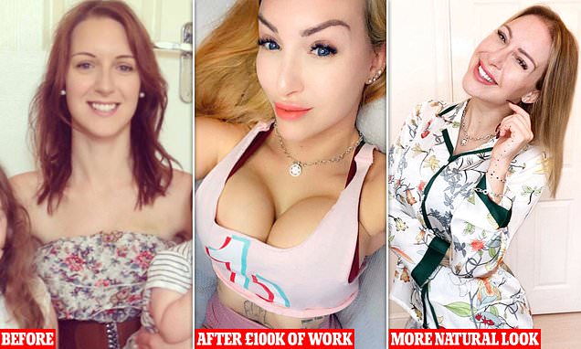 Woman who spent £100k on her appearance strips back to natural look