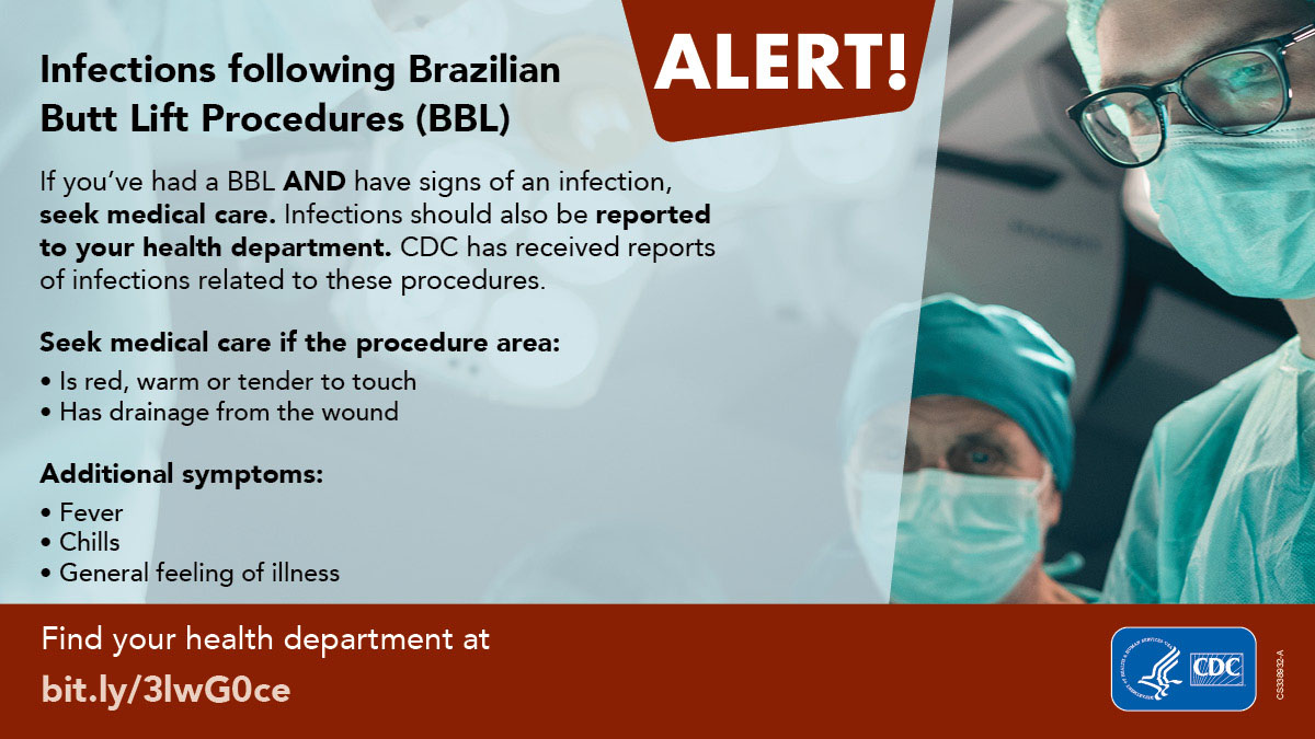 Image alerts patients to symptoms of infection following Brazilian Butt Lift Procedures. 

If you’ve had a BBL AND have signs of an infection, seek medical care. Infections should also be reported to your health department. CDC has received reports of infections related to these infections. Seek medical care if the procedure area is read, warm, or tender to the touch, or has drainage from the wound. 
Additional symptoms include fever, chills or a general feeling of illness. Find your health department at bit.ly/3lwG0ce 
