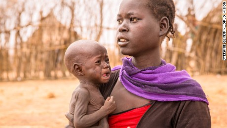 Adele Bol walked for over three hours to get to the food distribution with her 10 month old daughter Akir. Adele hast two other children at home who are similarly malnourished.  