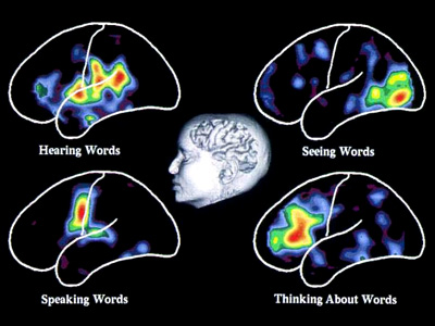 Brain model showing different parts activated, as described in the text